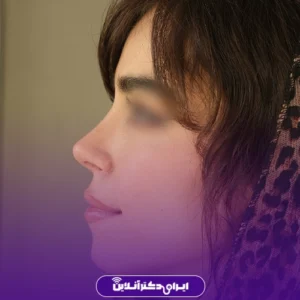 نمونه کار عمل بینی دکتر لیلا ملکی 1