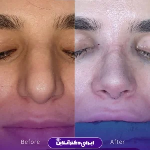 نمونه کار دکتر لیلا مشعلی 1