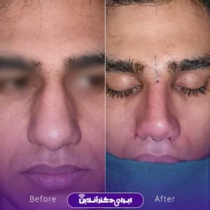 نمونه کار دکتر لیلا مشعلی - 10