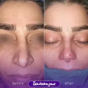 نمونه کار دکتر لیلا مشعلی 2