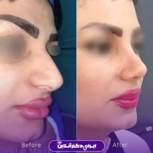 نمونه کار دکتر لیلا مشعلی 3