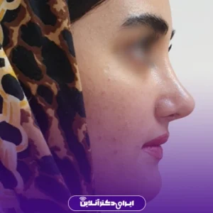نمونه کار دکتر لیلا مشعلی 4