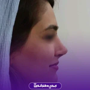 نمونه کار دکتر لیلا مشعلی 5