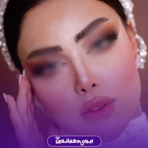 نمونه کار دکتر لیلا مشعلی 6