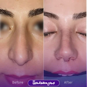 نمونه کار دکتر لیلا مشعلی 7