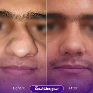 نمونه کار دکتر لیلا مشعلی 8
