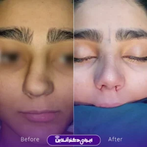 نمونه کار دکتر لیلا مشعلی 9