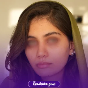نمونه کار عمل بینی دکتر لیلا ملکی 10