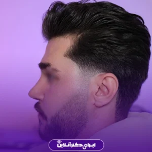 نمونه کار عمل بینی دکتر معصومه نیازی 1