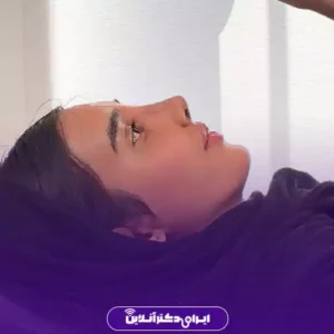 نمونه کار عمل بینی گوشتی دکتر محمد عابدی 5