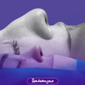 نمونه کار عمل بینی دکتر محمد عابدی 4