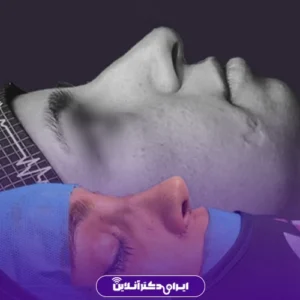 نمونه کار عمل بینی دکتر محمد عابدی 5