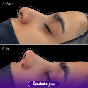 نمونه کار عمل بینی دکتر محمدحسین دادگرنیا 2