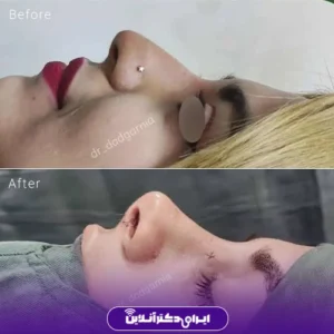 نمونه کار عمل بینی دکتر محمدحسین دادگرنیا 4