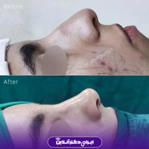 نمونه کار عمل بینی دکتر محمدحسین دادگرنیا 5