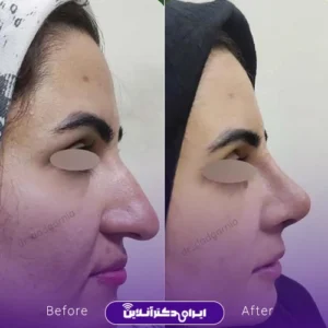 نمونه کار عمل بینی دکتر محمدحسین دادگرنیا 6