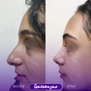 نمونه کار عمل بینی دکتر محمدحسین دادگرنیا 7