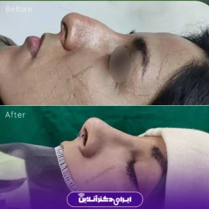 نمونه کار عمل بینی دکتر محمدحسین دادگرنیا 8
