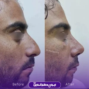 نمونه کار عمل بینی دکتر محمدحسین دادگرنیا 9