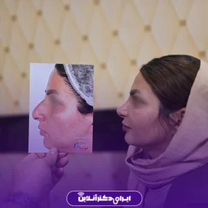 نمونه کار عمل بینی دکتر محمدمهدی صاحبی بزاز 3