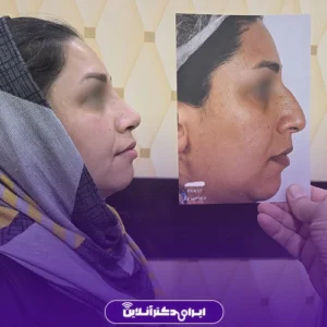 نمونه کار عمل بینی دکتر محمدمهدی صاحبی بزاز 6