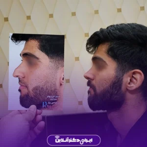 نمونه کار عمل بینی دکتر محمدمهدی صاحبی بزاز 7