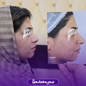 نمونه کار عمل بینی دکتر محمدمهدی صاحبی بزاز 4