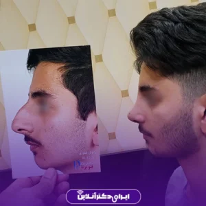 نمونه کار عمل بینی دکتر محمدمهدی صاحبی بزاز 8