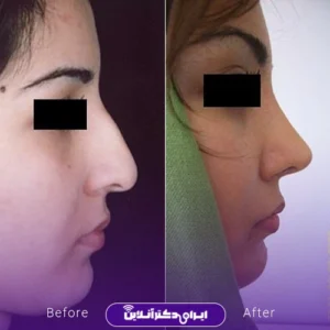 نمونه کار عمل بینی دکتر محمدرضا سلیمی 9