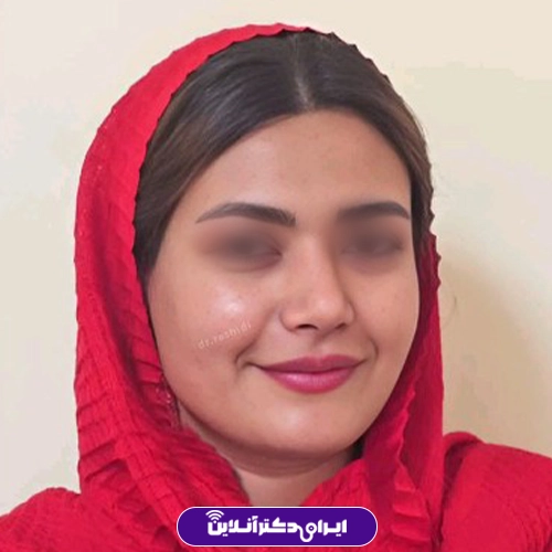 بهترین جراح بینی در زاهدان + راهنمای جامع عمل بینی و هزینه 1405 127 نمونه کار جراحی بینی دکتر محسن رشیدی راوری 1