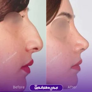 نمونه کار عمل بینی دکتر شادی جوادی 9