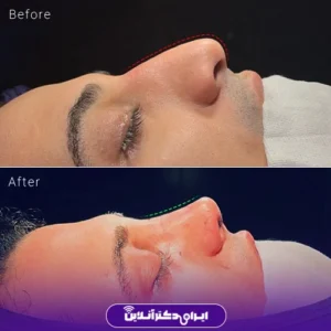 نمونه کار دکتر شاهرخ خوش سیرت 3