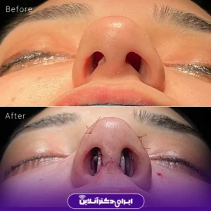 نمونه کار دکتر شاهرخ خوش سیرت 4