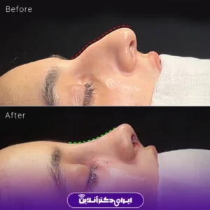 نمونه کار دکتر شاهرخ خوش سیرت 5