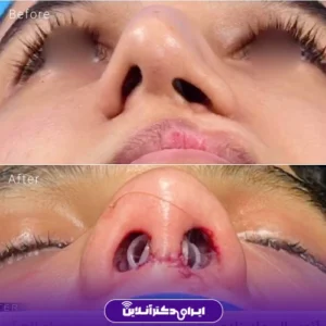 نمونه کار دکتر شاهرخ خوش سیرت 7