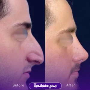 نمونه کار دکتر شاهرخ خوش سیرت 8