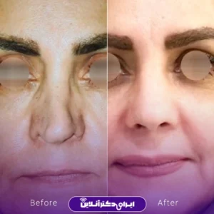 نمونه کار دکتر شاهرخ خوش سیرت 9