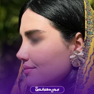 نمونه کار عمل بینی دکتر لیلا ملکی 4