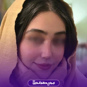 نمونه کار عمل بینی دکتر لیلا ملکی 5