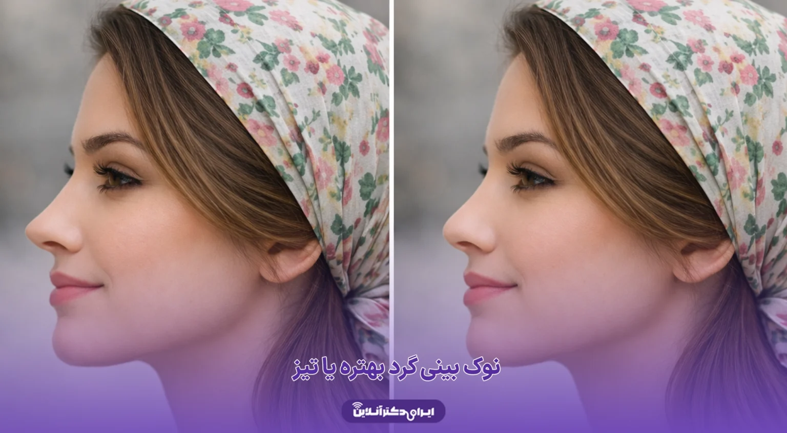 نوک بینی گرد بهتره یا تیز