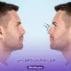 فرق رینوپلاستی با عمل بینی