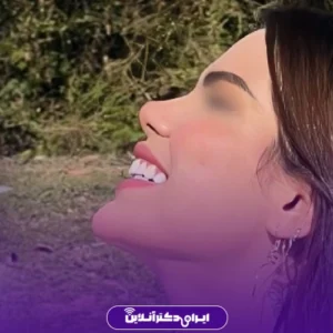 نمونه کار عمل بینی دکتر آرش طهماسبی 1