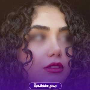 نمونه کار عمل بینی دکتر آرش طهماسبی 7