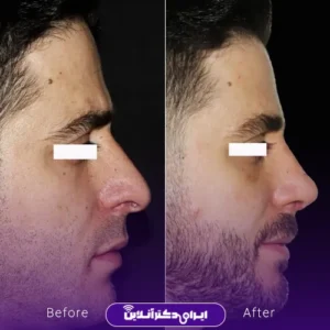 نمونه کار دکتر ماکان شالچی زاده خامنه پور - 10