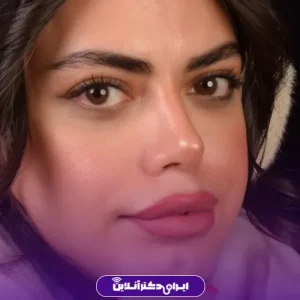 نمونه کار عمل بینی دکتر علیرضا سلطانی فر 2