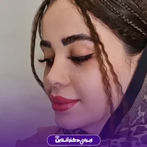 نمونه کار عمل بینی دکتر علیرضا سلطانی فر 5