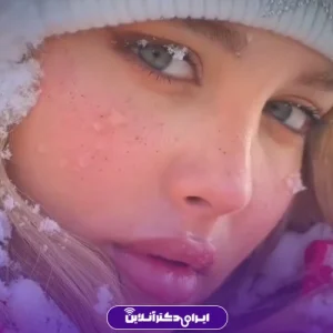 نمونه کار عمل بینی دکتر علیرضا سلطانی فر 6