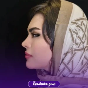 نمونه کار عمل بینی دکتر علیرضا سلطانی فر 7