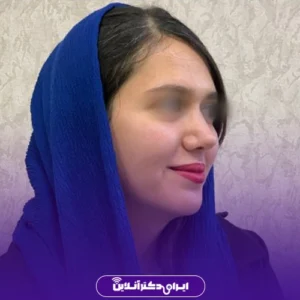 نمونه کار عمل بینی دکتر حبیب سهرابی 10