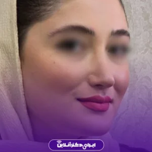 نمونه کار عمل بینی دکتر حبیب سهرابی 6